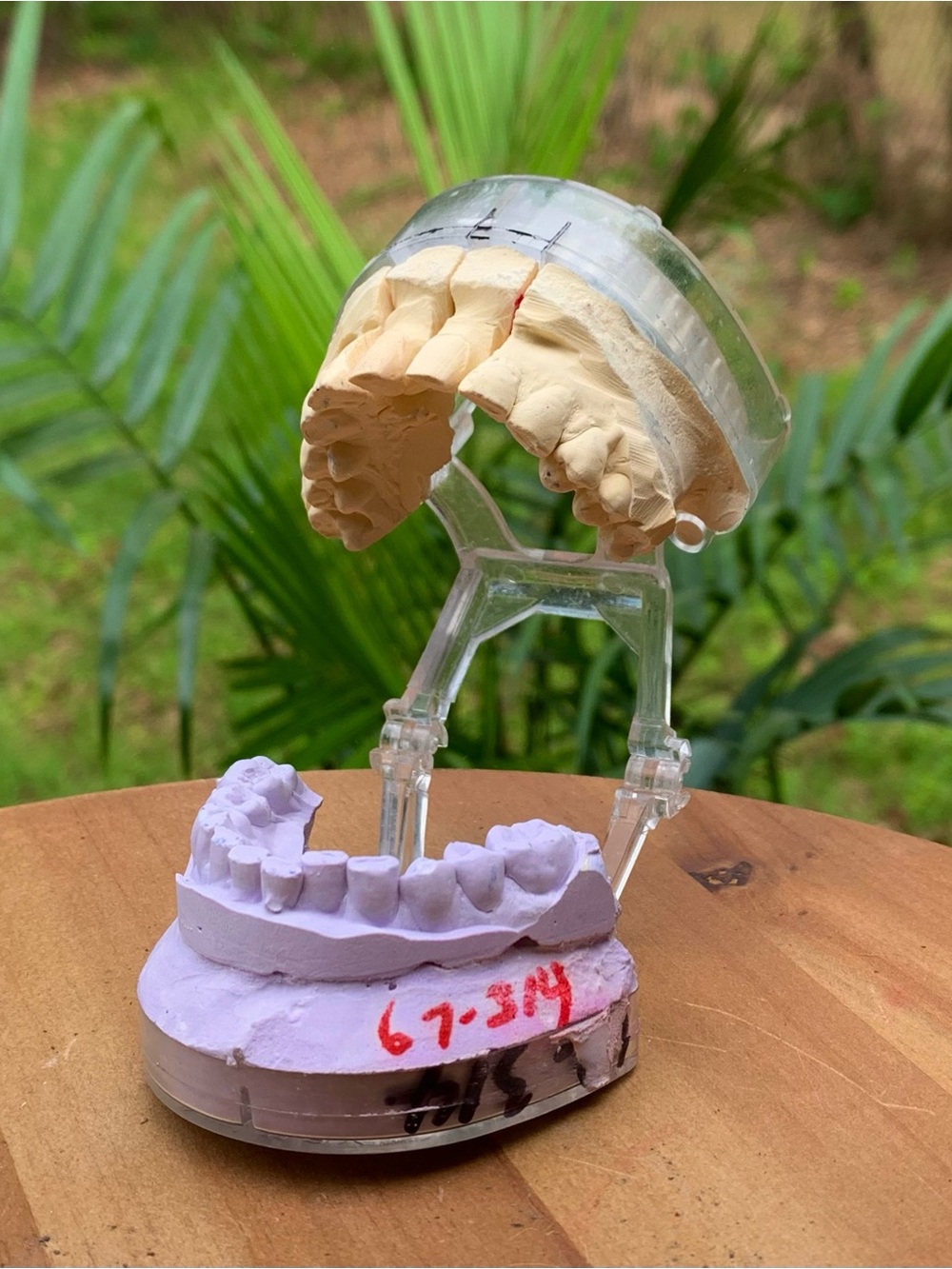 Unique Medical Oddity x Dental Plaster Teeth Model